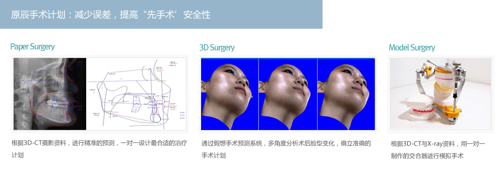 韩国两颚手术哪家医院做的好