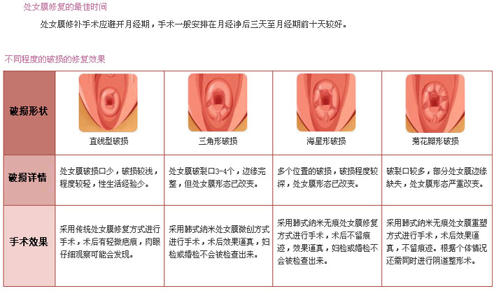 处女膜 想知道处女膜是否已经破裂！该怎么检查才能看的出？ - 知乎