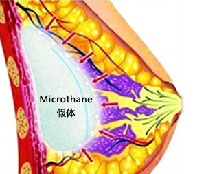 Microthane