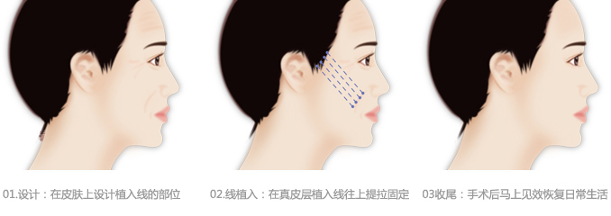 手术过程