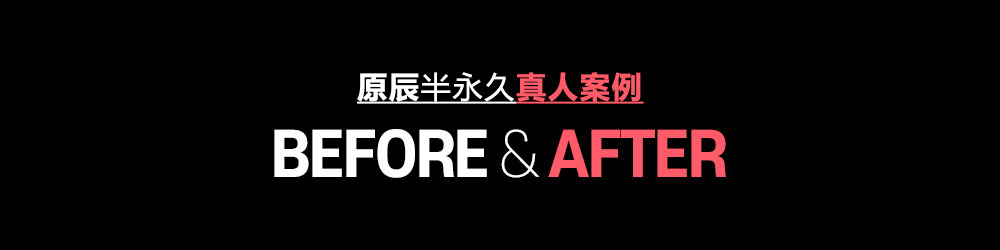 原辰半永久真人案例