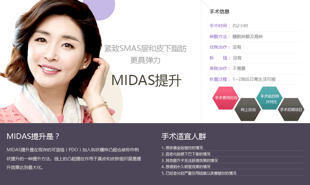 MIDAS