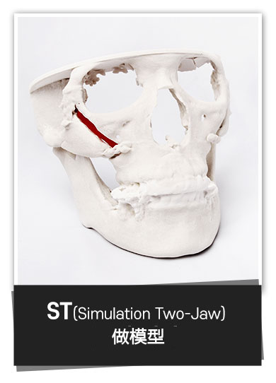 ST(Simulation Two-Jow) 모델 제작
