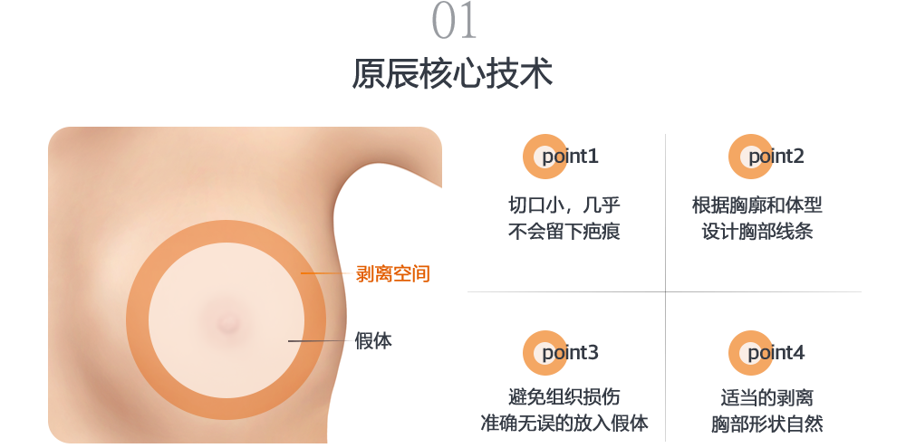 01 보형물 핸들링 기술력